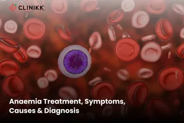 Anaemia Treatment, Symptoms, Causes & Diagnosis