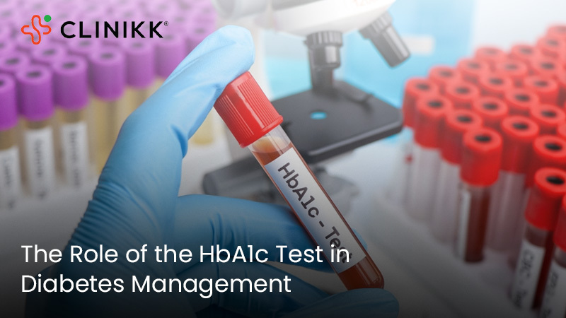 The Role of the HbA1c Test