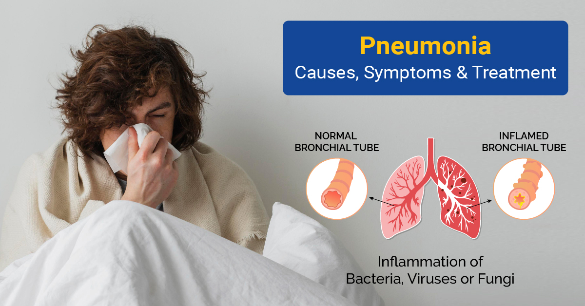 Best Pneumonia Treatment in Bengaluru - Clinikk Health Hub