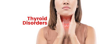 thyroid disorder issues