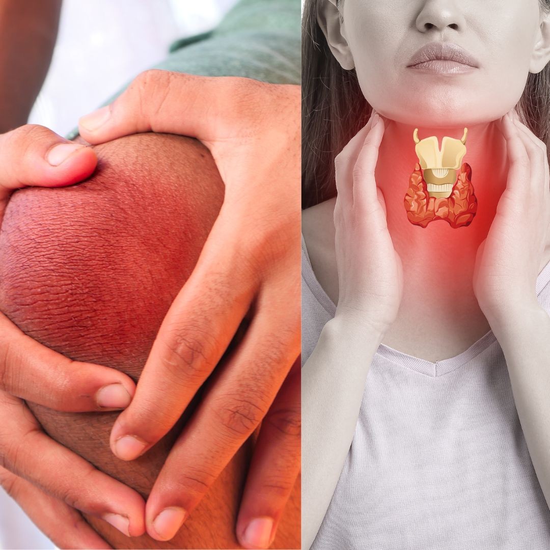 thyroid joint pain