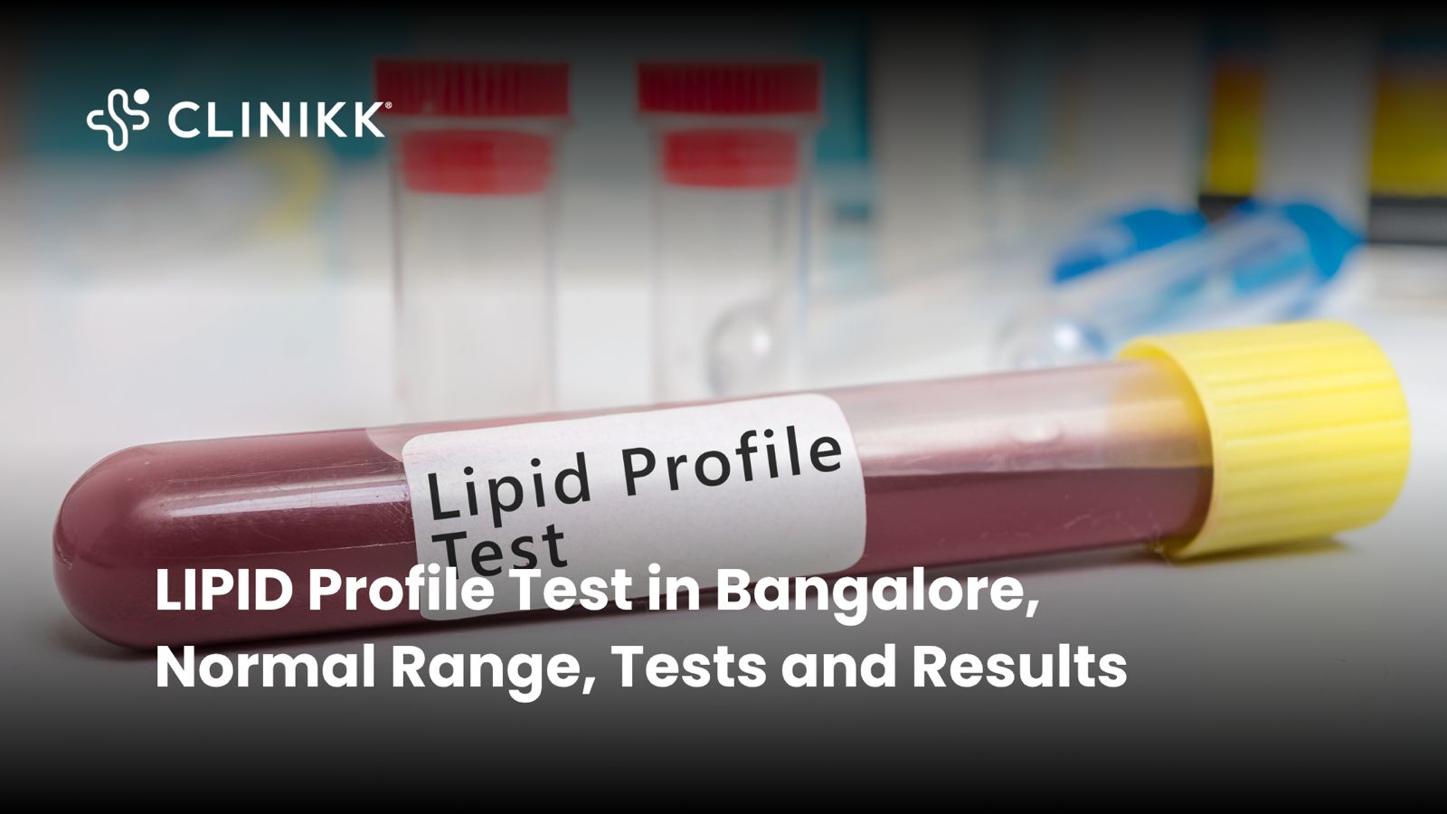 Lipid profile test in Bangalore