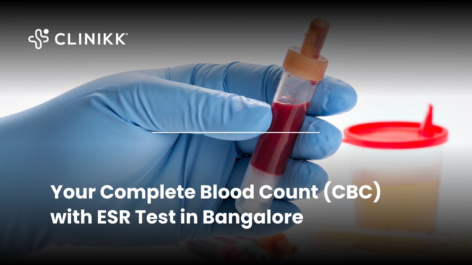 Complete Blood Count (CBC) with ESR Test in Bangalore