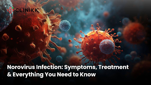 Norovirus Infection: Symptoms, Treatment