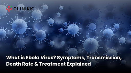 Ebola Virus